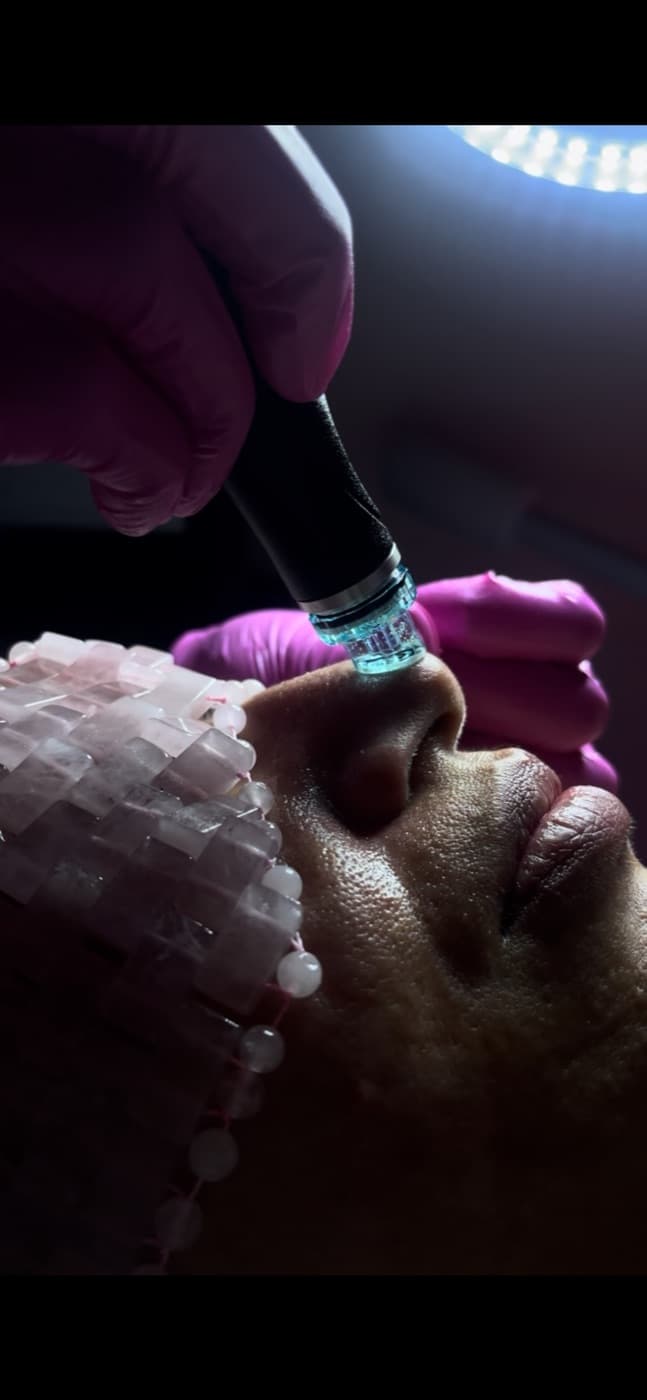 HydraFacial at Lavish Beauty Calgary