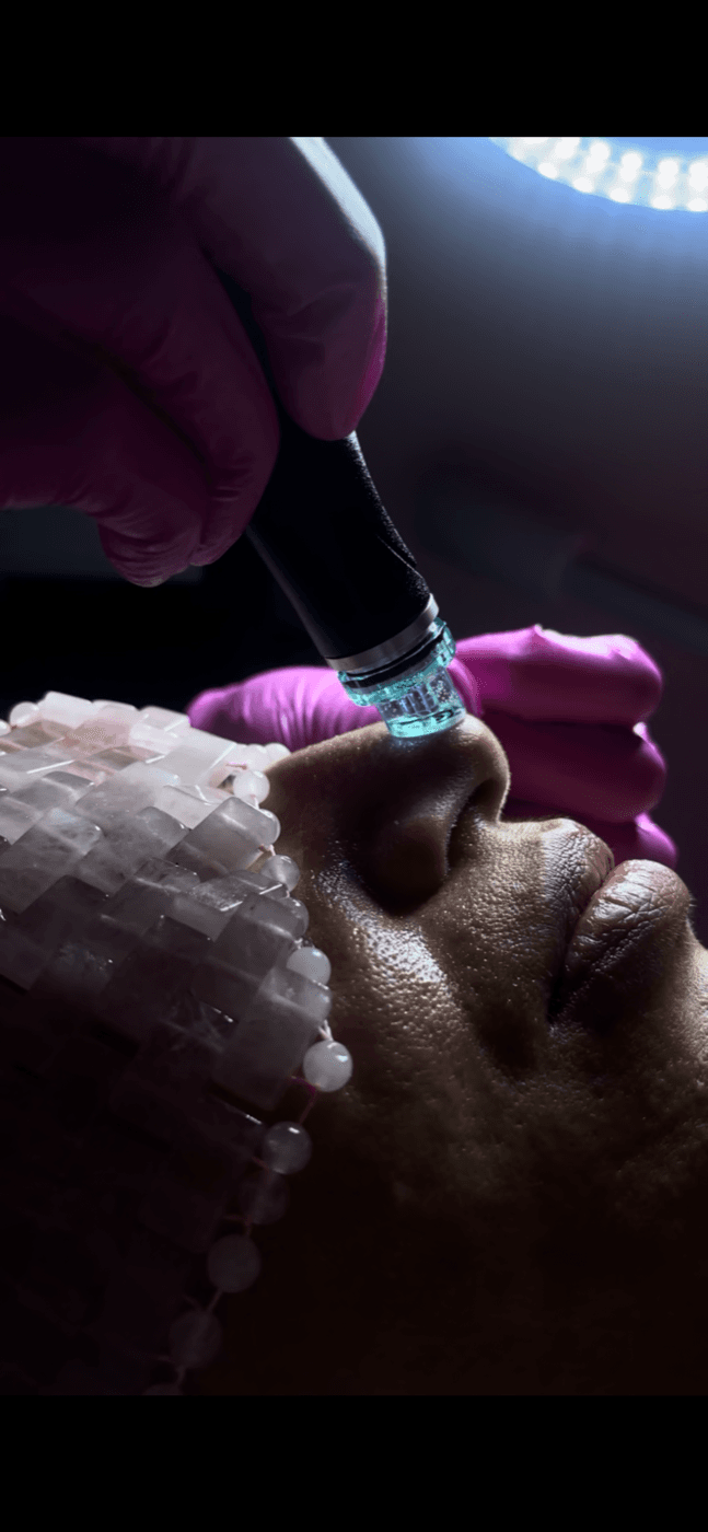 HydraFacial at Lavish Beauty Calgary